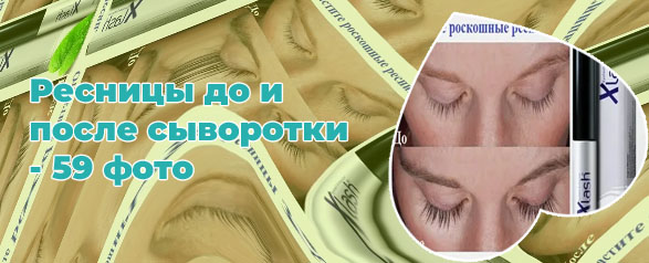 Сыворотка для роста ресниц фото